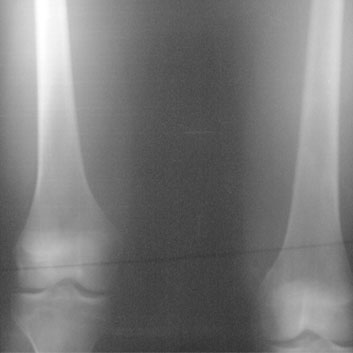 Aghasi-Xray.jpg