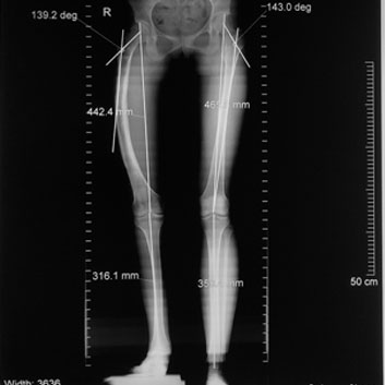 gayane_Xray.jpg